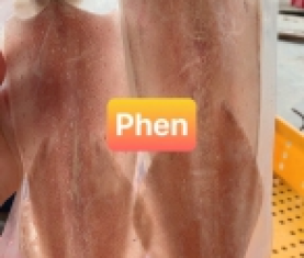 MỰC 1 NẮNG